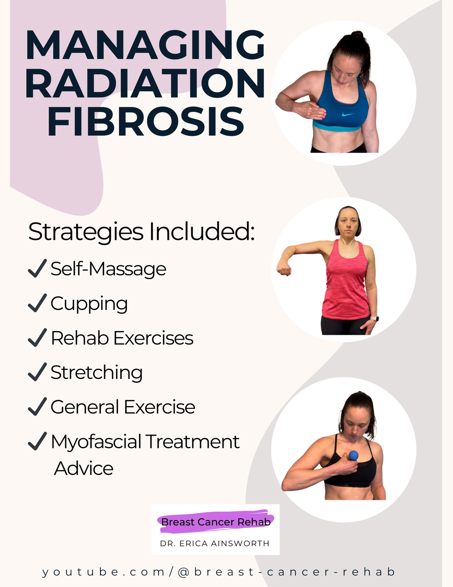 Radiation Fibrosis Treatment Guide